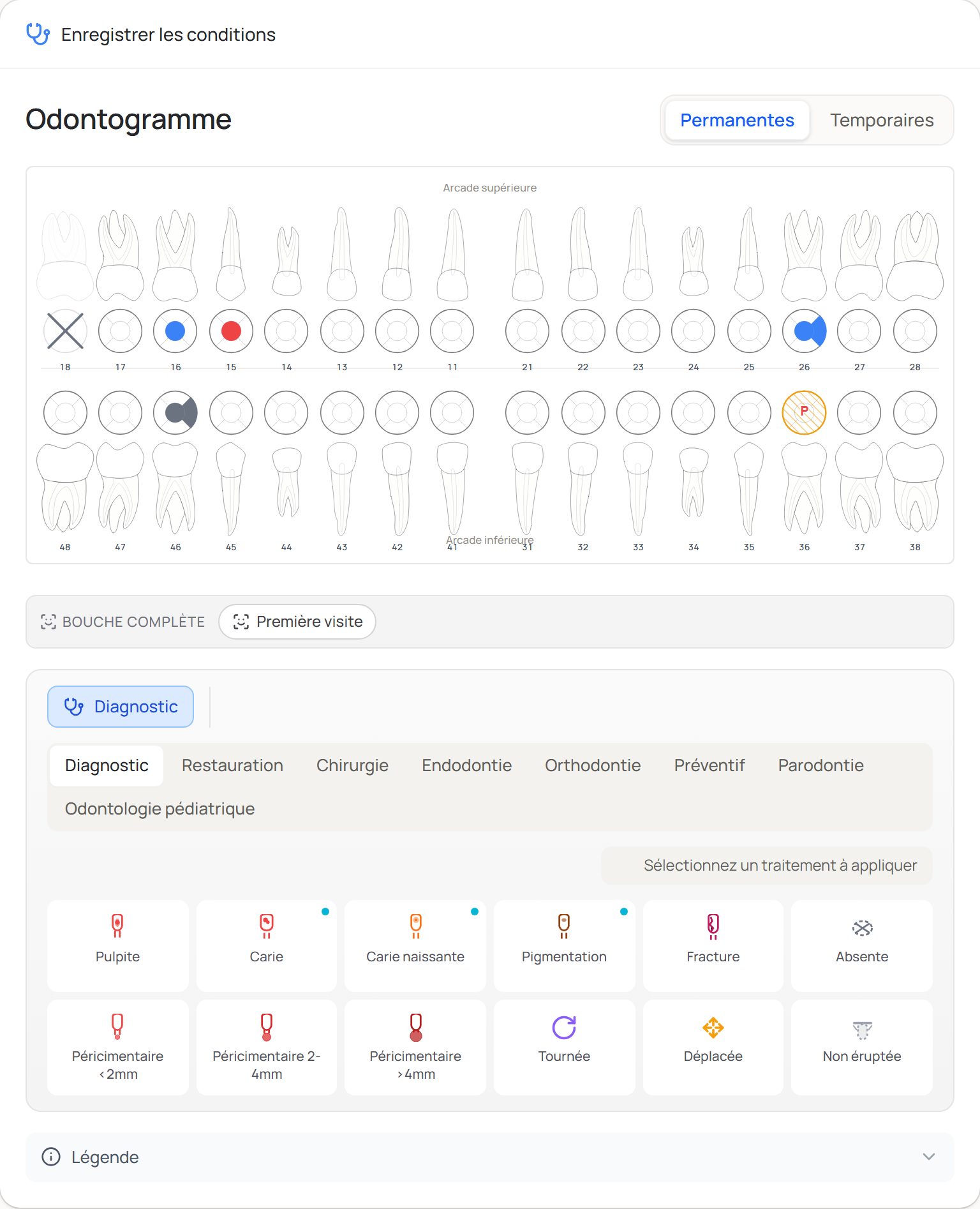 Odontogramme